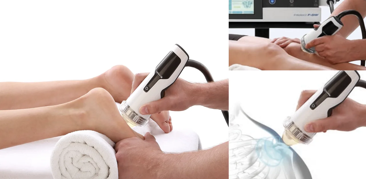 Shockwave therapy treatment applied to a patient at Mattia Spinal Care & Rehab Center in Orlando