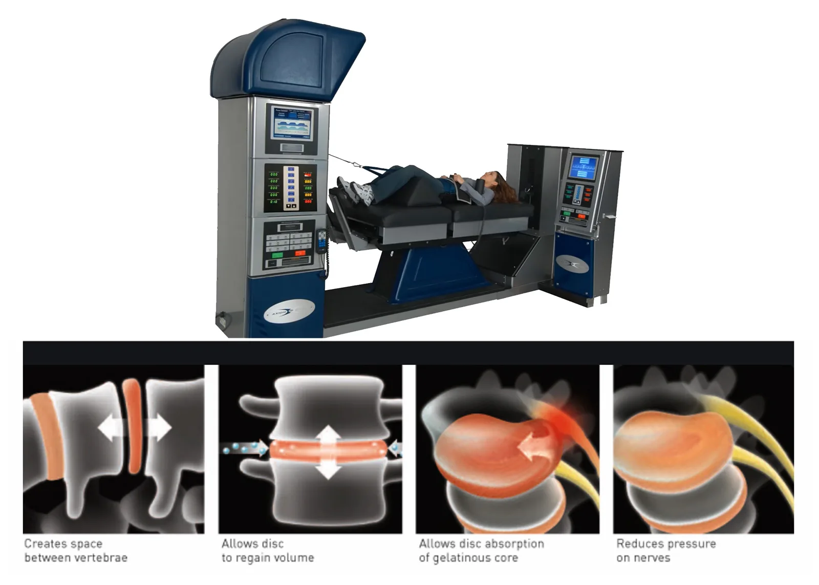 DRX-9000 decompression table with diagrams showing how decompression creates space between vertebrae, restores disc volume, and reduces pressure on nerves